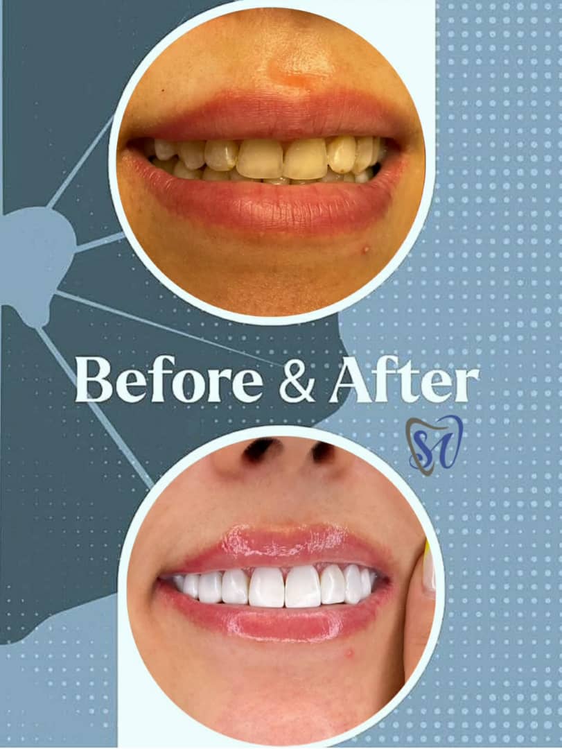 مطب دندانپزشکی دکتر سیما موسوی در سیدخندان تهران